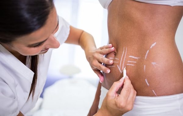 Best abdominoplasty clinics