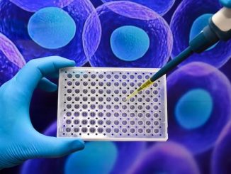 Stem Cell Treatment
