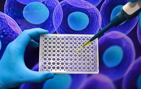 Stem Cell Treatment