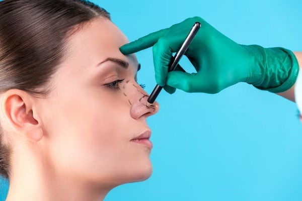 Types of rhinoplasty