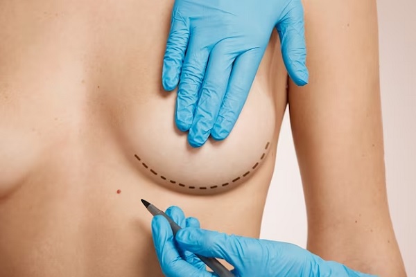 breast aesthetic clinic