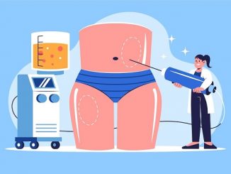 liposuction clinics in Istanbul Turkey